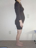 健友館きむら整体院骨盤美容矯正前